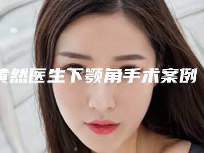 黄然医生下颚角手术案例-价格(费用)清单超新强势推出